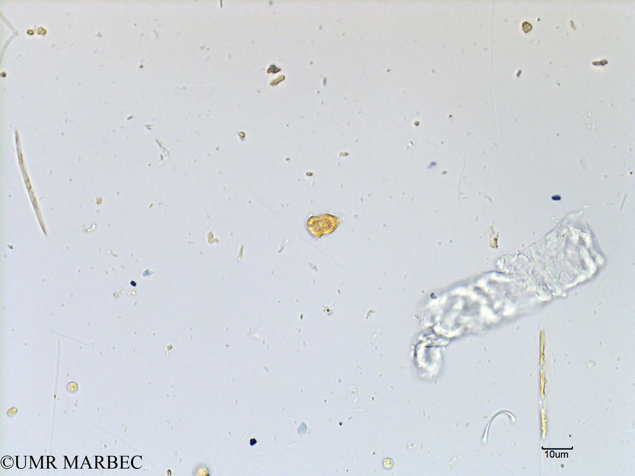 phyto/Scattered_Islands/mayotte_lagoon/SIREME May 2016/Protoperidinium bipes (MAY5_heterocapsa ou azadinium-2).tif(copy).jpg